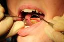 The move aims to increase access to NHS dental treament. Picture: Newsquest