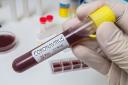 Hand holds test tube for Coronavirus 2019-nCOV analysis..