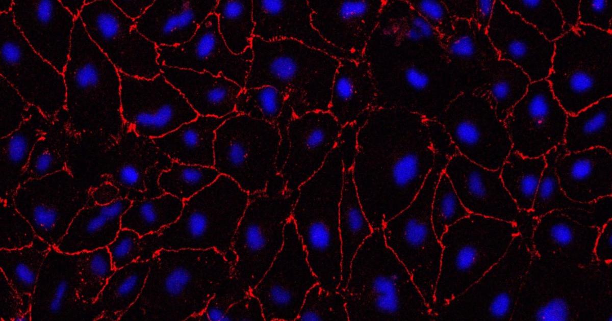 Lab-grown small blood vessels 'indicate treatment for major cause of stroke' - Vimarsana News
