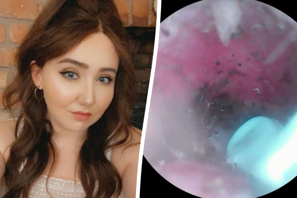 Woman 'completely shocked' to find spider nest in her ear | Somerset County Gazette - Vimarsana News