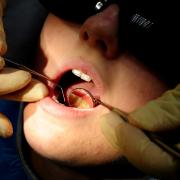 Taunton residents unable to register with dentist amid NHS shortage