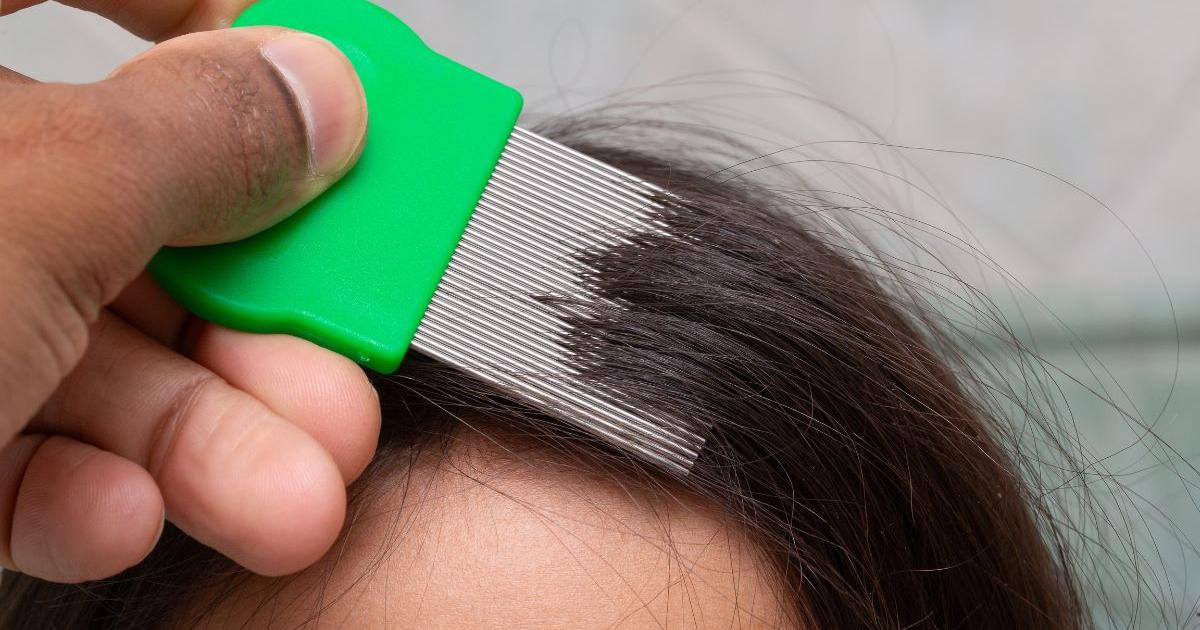 What to do if you have head lice - how to get rid of nits